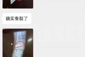 当事人！某青训小孩母亲控诉孙继海和嗨球少年中国青训真难